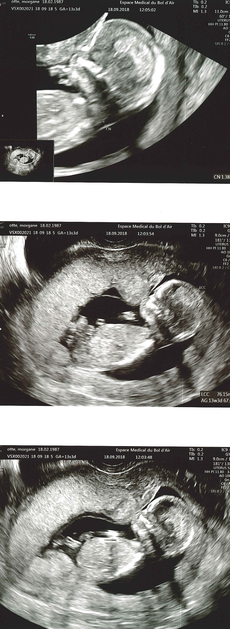 morgane.otte_18-09-2018_15-27-23